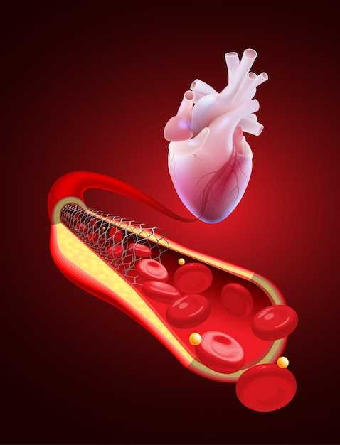 Rosuvastatin calcium in acute coronary syndromes